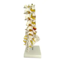 VERTABRA KESİT MODELİ