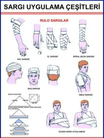 Sargı Sarma Şekillerini Gösteren Poster