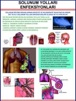 Solunum Yolları Enfeksiyonları Eğitim Plakası