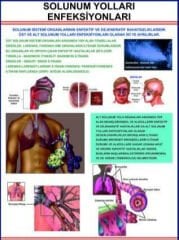 Solunum Yolları Enfeksiyonları Eğitim Plakası
