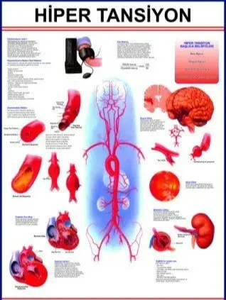 Hipertansiyon Eğitim Plakası