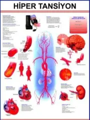 Hipertansiyon Eğitim Plakası