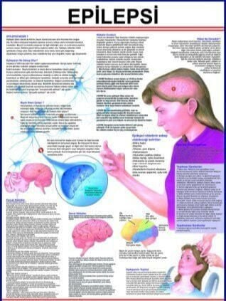 Epilepsi Eğitim Plakası