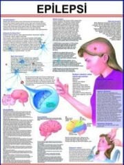 Epilepsi Eğitim Plakası