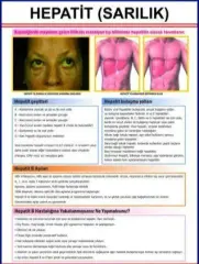 Hepatit Eğitim Plakası
