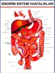 Sindirim Sistemi Hastalıkları Eğitim Plakası