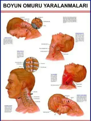Baş Ve Boyun Yaralanmaları Eğitim Plakası