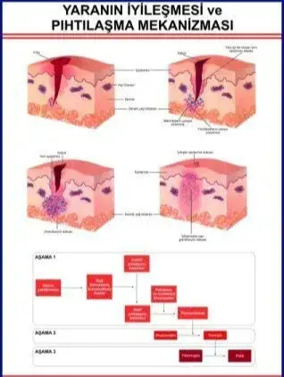 YARANIN İYİLEŞMESİ EĞİTİM LEVHASI