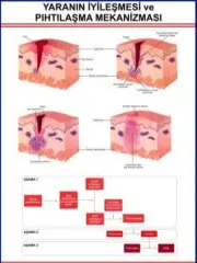 YARANIN İYİLEŞMESİ EĞİTİM LEVHASI